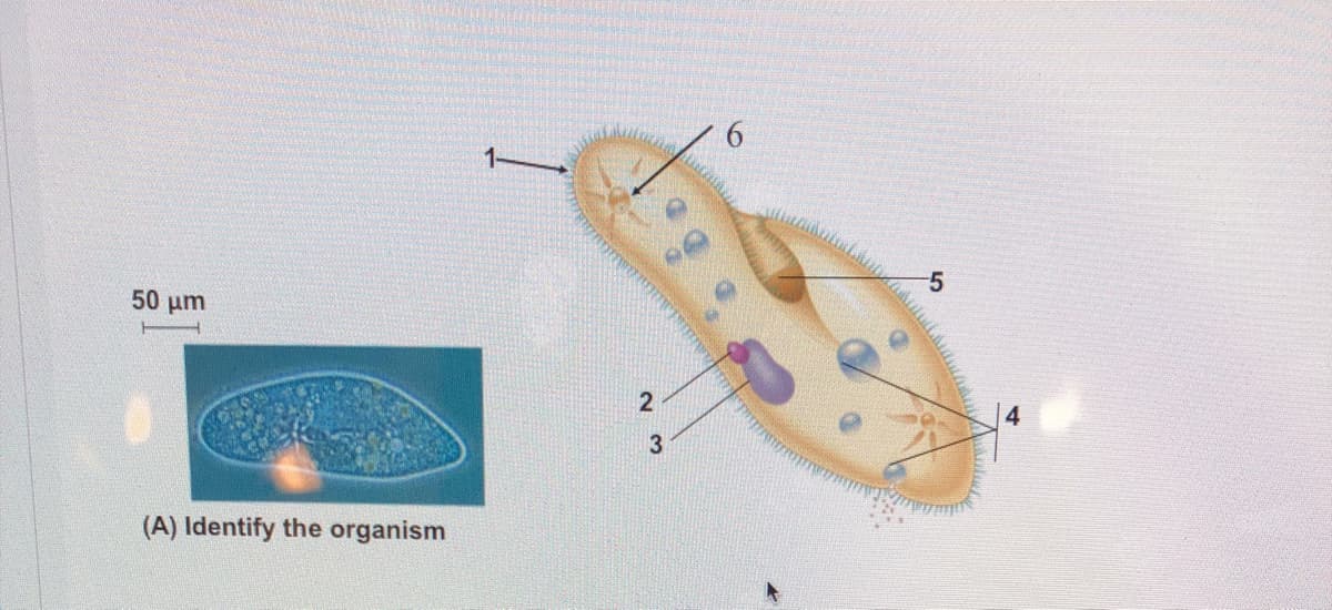 6.
-5
50 um
(A) Identify the organism
