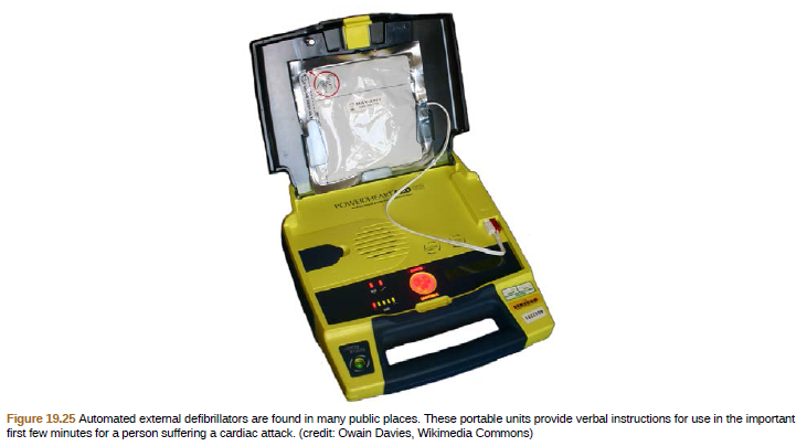POWEREAKT
Figure 19.25 Automated extemal defibrillators are found in many public places. These portable units provide verbal instructions for use in the important
first few minutes for a person suffering a cardiac attack. (credit: Owain Davies, Wikimedia Commons)
