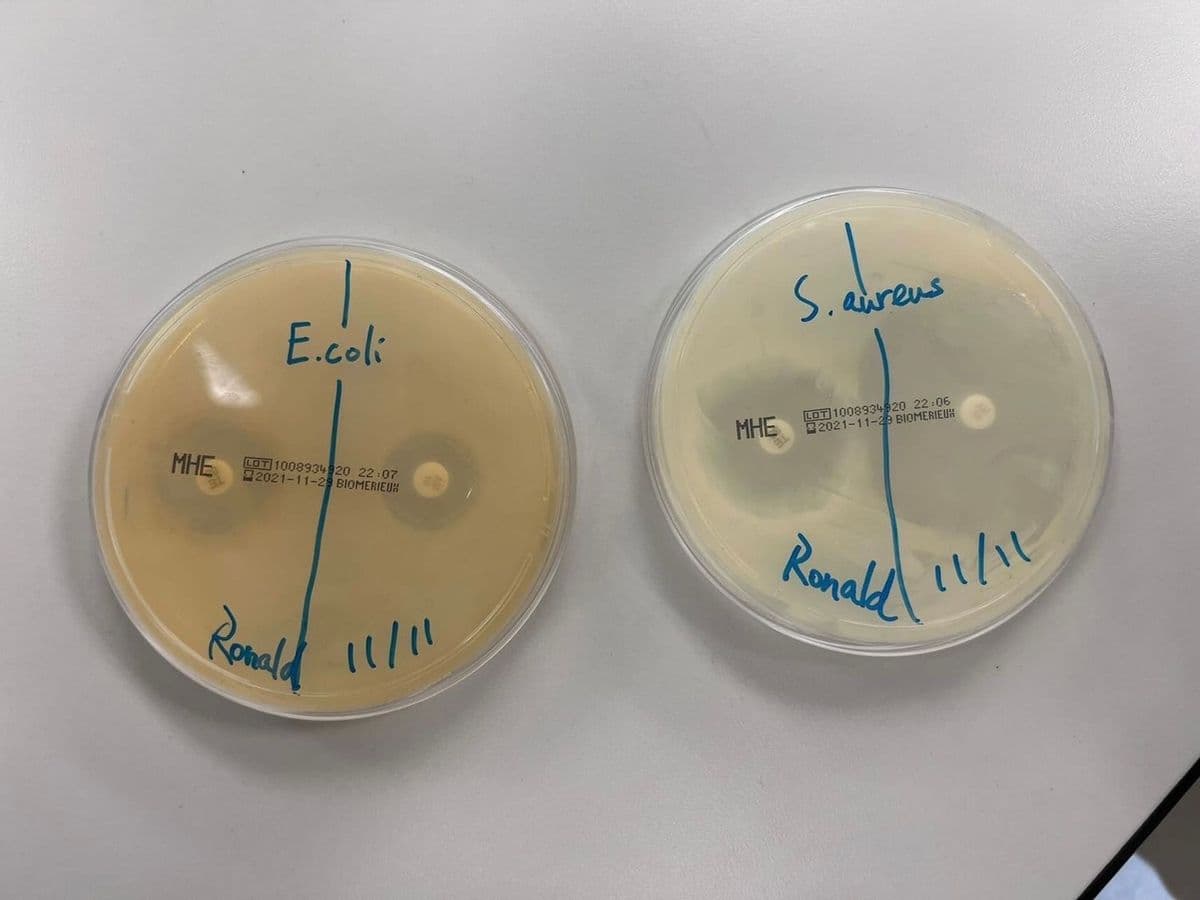 S. aureus
E.coli
LOT 100893420 22:06
2021-11-29 BIOMERIEUH
MHE
MHE
LOT 1008934920 22:07
22021-11-29 BIOMERIEUH
11/1
Ronald
Ronald
11/1
