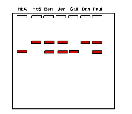 HbA HbS Ben Jen Gail Dan Paul
