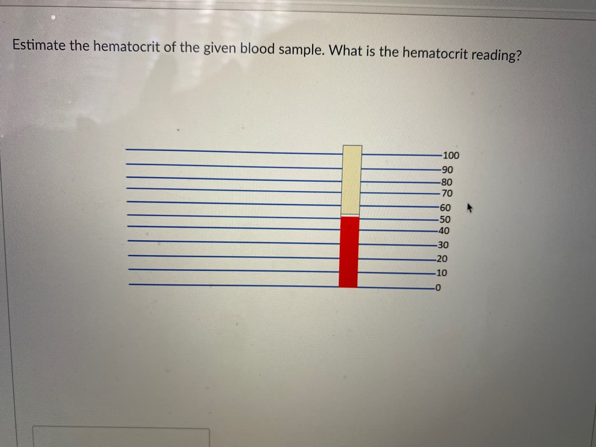 Estimate the hematocrit of the given blood sample. What is the hematocrit reading?
-100
-90
-80
70
-60
50
40
30
20
-10
