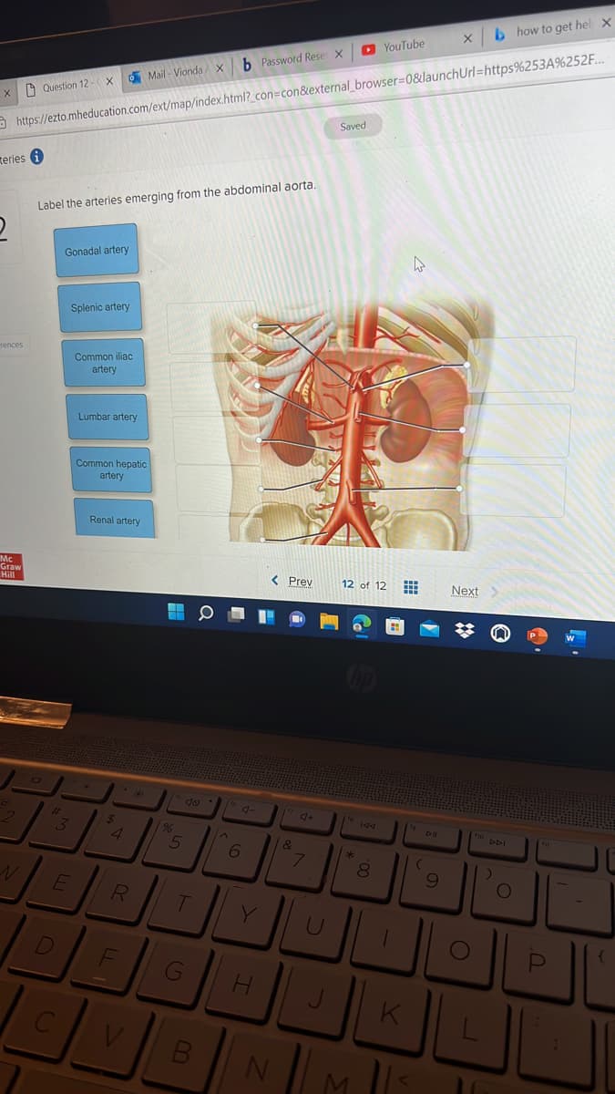 b how to get hel x
O YouTube
b Password Rese X
6 Mail - Vionda x
X D Question 12 -x
O https://ezto.mheducation.com/ext/map/index.html?_con=con&external_browser=0&launchUrl=https%253A%252F..
Saved
teries i
Label the arteries emerging from the abdominal aorta.
Gonadal artery
Splenic artery
rences
Common iliac
artery
Lumbar artery
Common hepatic
artery
Renal artery
Mc
Graw
Hill
< Prev
12 of 12
Next
do g-
4.
96
ho DDI
080
RI
D
G
K
C
V
