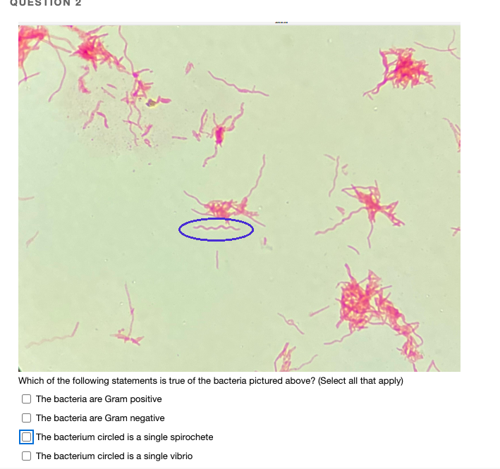 Which of the following statements is true of the bacteria pictured above? (Select all that apply)
The bacteria are Gram positive
The bacteria are Gram negative
The bacterium circled is a single spirochete
The bacterium circled is a single vibrio
