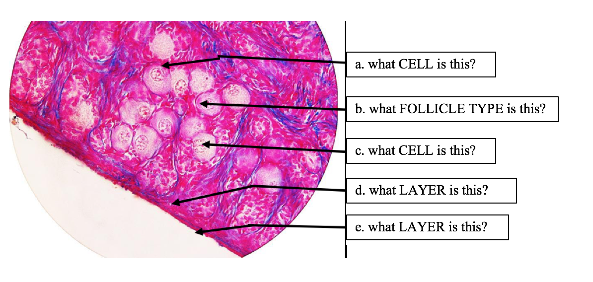 a. what CELL is this?
b. what FOLLICLE TYPE is this?
c. what CELL is this?
d. what LAYER is this?
e. what LAYER is this?
