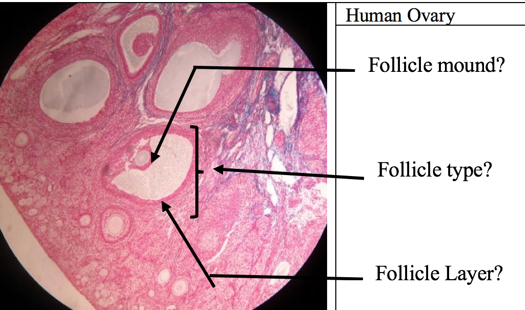 Human Ovary
Follicle mound?
Follicle type?
Follicle Layer?
