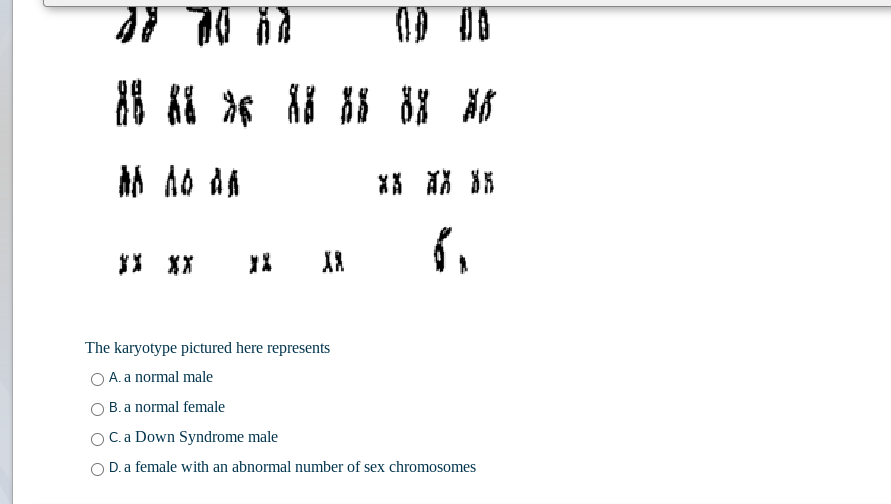 器 * A8 HS B8 M
*器 S
The karyotype pictured here represents
O A. a normal male
B. a normal female
OC.a Down Syndrome male
D. a female with an abnormal number of sex chromosomes

