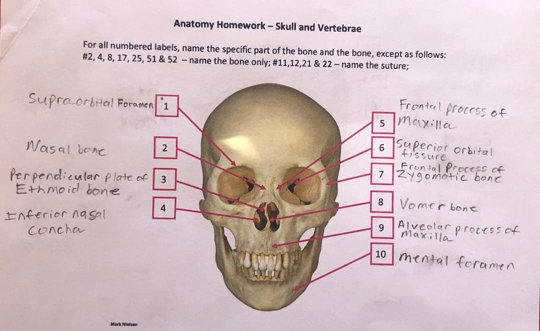 Anatomy Homework - Skull and Vertebrae
For all numbered labels, name the specific part of the bone and the bone, except as follows:
#2, 4, 8, 17, 25, 51 & 52-name the bone only; #11,12,21 & 22- name the suture;
Supraorbital Foramen 1
Fronterl procesS of
maxilla
Superior orbital
fissure
6.
Wasal bone
Frontal Process of
7
Zygomátic bone
Perpendicular plate of
Ethmoid bone
3
8
Vomer bone
4
Alveolar process of
Inferior nasal
Concha
9.
Maxilla
10
mental foramen
Mark Nielsen
