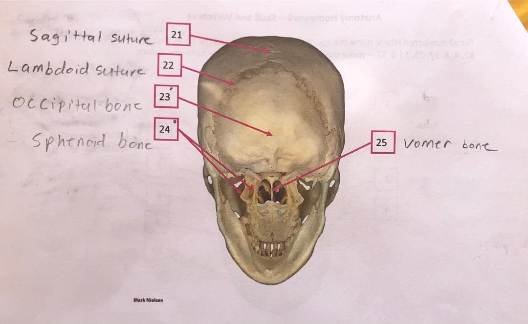 Sagittal suture
21
msn
Lambdoid suture
22
23
Occipital bone
24
Sphenoid bone"
Vomer bone
25
Mark Nielsen
