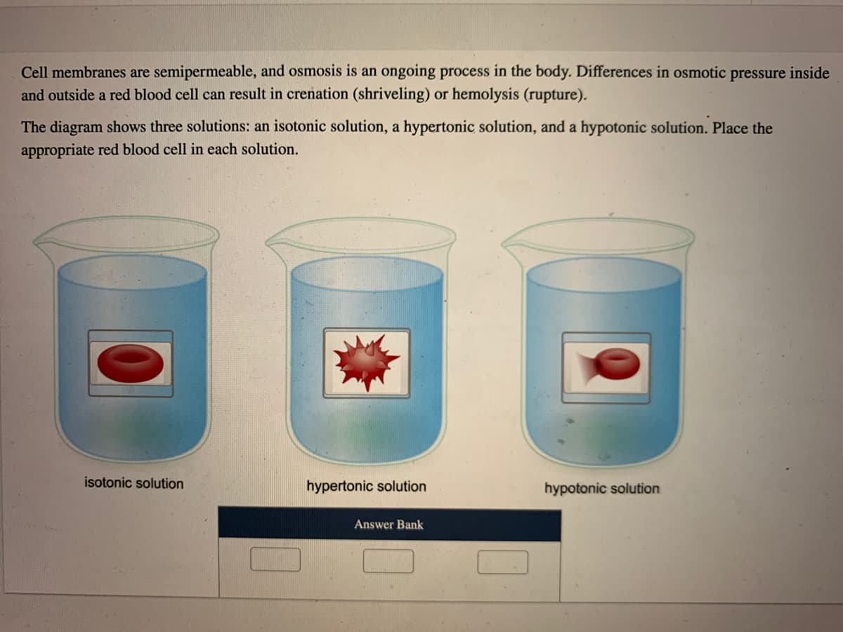Cell membranes are semipermeable, and osmosis is an ongoing process in the body. Differences in osmotic
and outside a red blood cell can result in crenation (shriveling) or hemolysis (rupture).
pressure inside
The diagram shows three solutions: an isotonic solution, a hypertonic solution, and a hypotonic solution. Place the
appropriate red blood cell in each solution.
isotonic solution
hypertonic solution
hypotonic solution
Answer Bank
