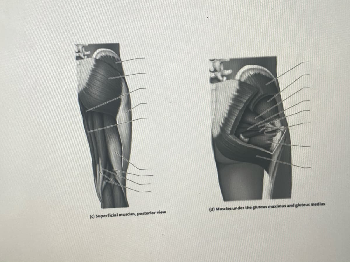 (c) Superficial muscles, posterior view
(d) Muscles under the gluteus maximus and gluteus medius
