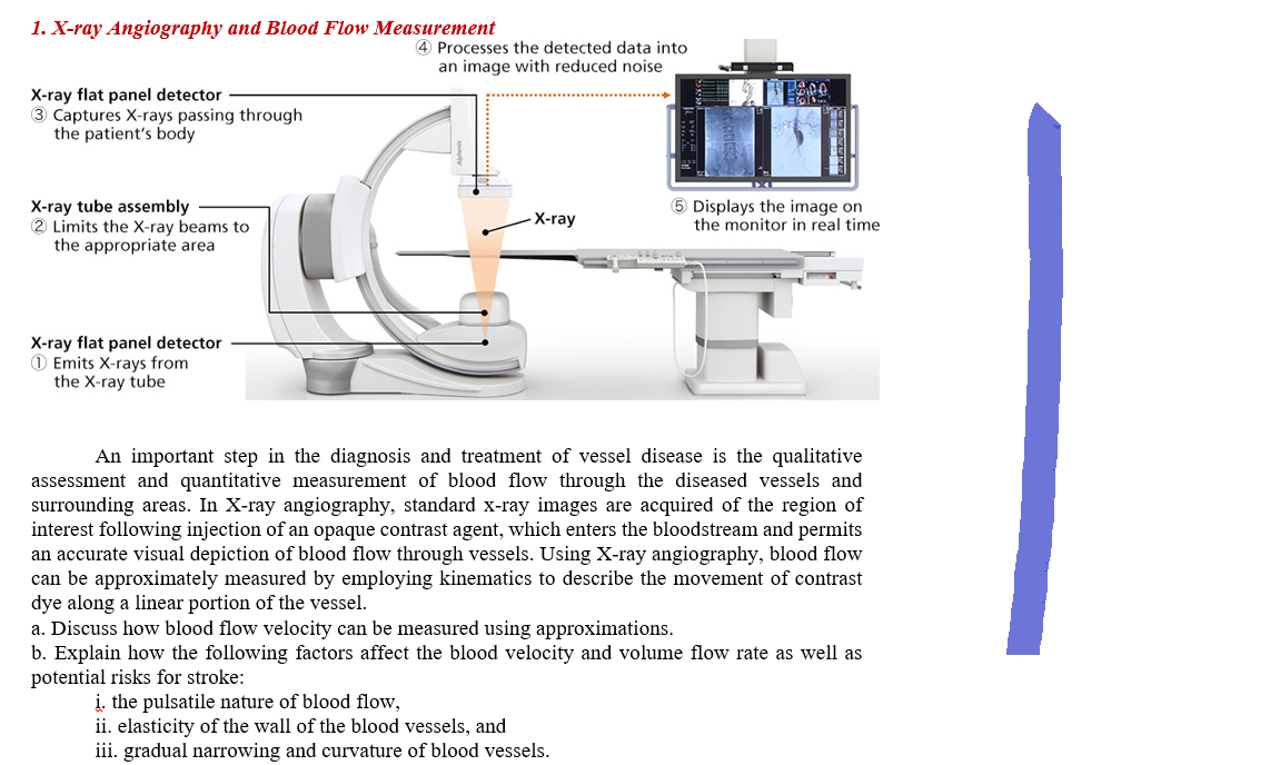 1. X-ray Angiography and Blood Flow Measurement
X-ray flat panel detector
3 Captures X-rays passing through
the patient's body
X-ray tube assembly
2 Limits the X-ray beams to
the appropriate area
X-ray flat panel detector
11 Emits X-rays from
the X-ray tube
4 Processes the detected data into
an image with reduced noise
-X-ray
200
5 Displays the image on
the monitor in real time
**A
An important step in the diagnosis and treatment of vessel disease is the qualitative
assessment and quantitative measurement of blood flow through the diseased vessels and
surrounding areas. In X-ray angiography, standard x-ray images are acquired of the region of
interest following injection of an opaque contrast agent, which enters the bloodstream and permits
an accurate visual depiction of blood flow through vessels. Using X-ray angiography, blood flow
can be approximately measured by employing kinematics to describe the movement of contrast
dye along a linear portion of the vessel.
a. Discuss how blood flow velocity can be measured using approximations.
b. Explain how the following factors affect the blood velocity and volume flow rate as well as
potential risks for stroke:
i. the pulsatile nature of blood flow,
ii. elasticity of the wall of the blood vessels, and
iii. gradual narrowing and curvature of blood vessels.