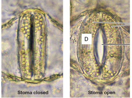 Stoma closed
D
Stoma open