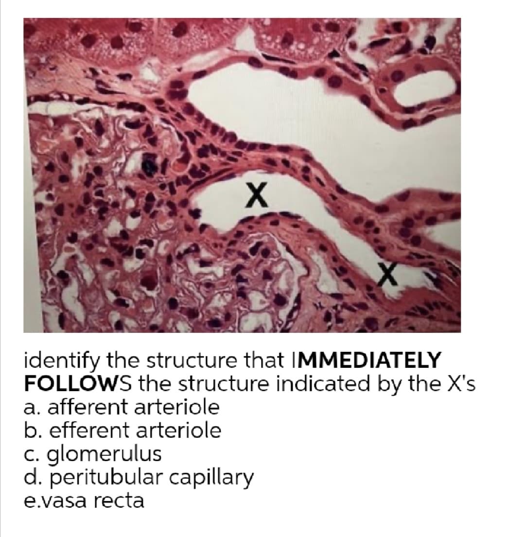identify the structure that IMMEDIATELY
FOLLOWS the structure indicated by the X's
a. afferent arteriole
b. efferent arteriole
c. glomerulus
d. peritubular capillary
e.vasa recta
