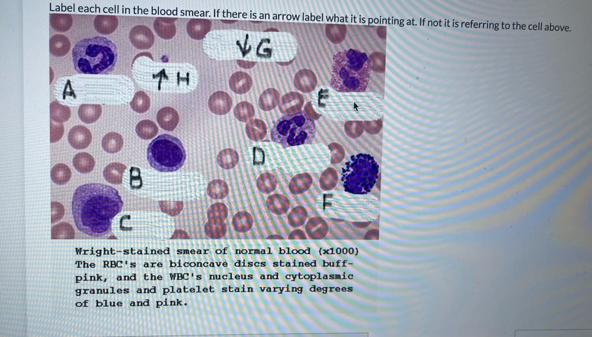 Label each cell in the blood smear. If there is an arrow label what it is pointing at. If not it is referring to the cell above.
VG
Wright-stained smear of normal blood (x1000)
The RBC' s are biconcave discs stained buff-
pink, and the WBC's nucleus and cytoplasmic
granules and platelet stain varying degrees
of blue and pink.
