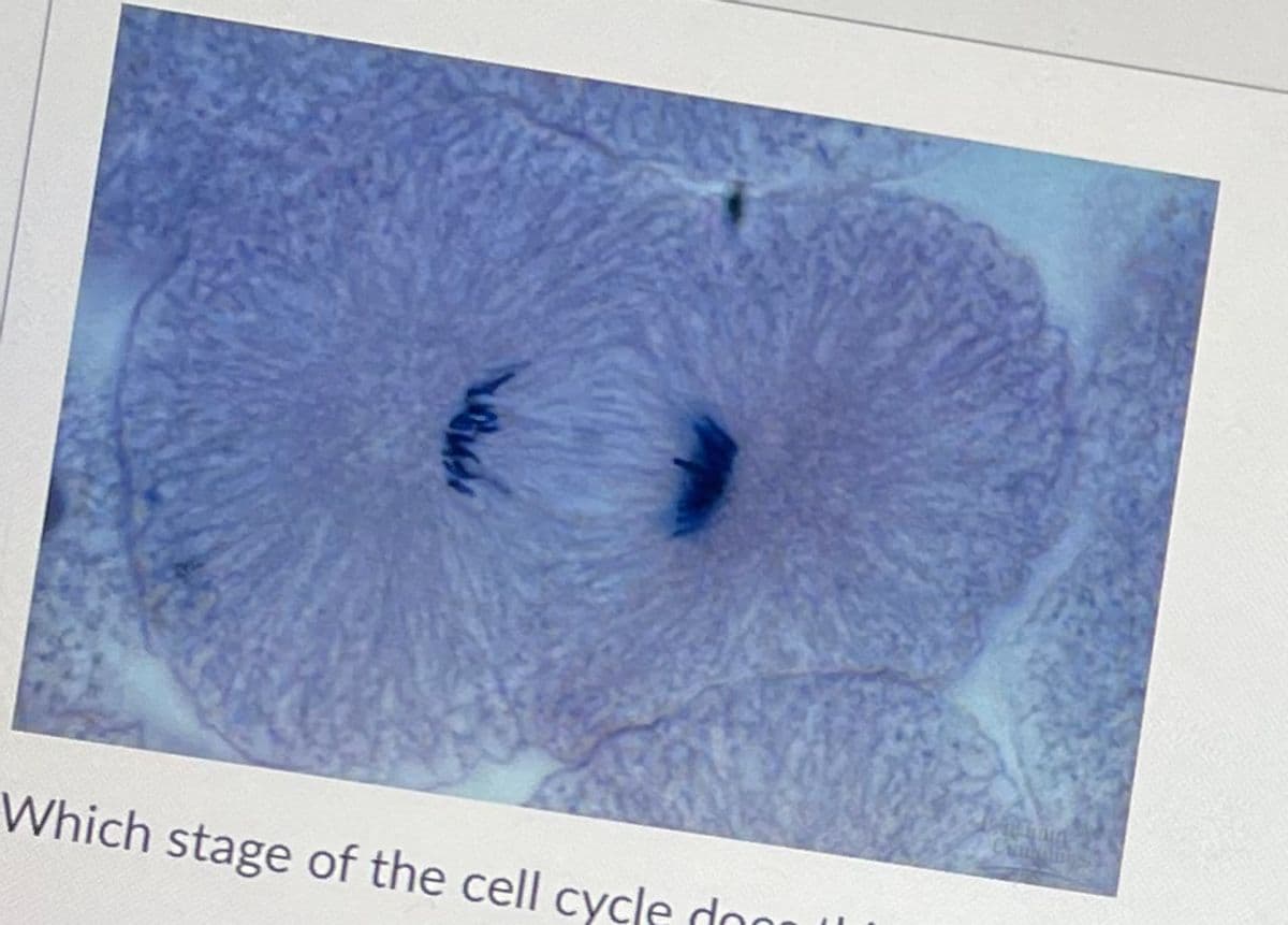 Which stage of the cell cycle don
