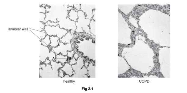 alveolar wall
healthy
COPD
Fig 2.1
