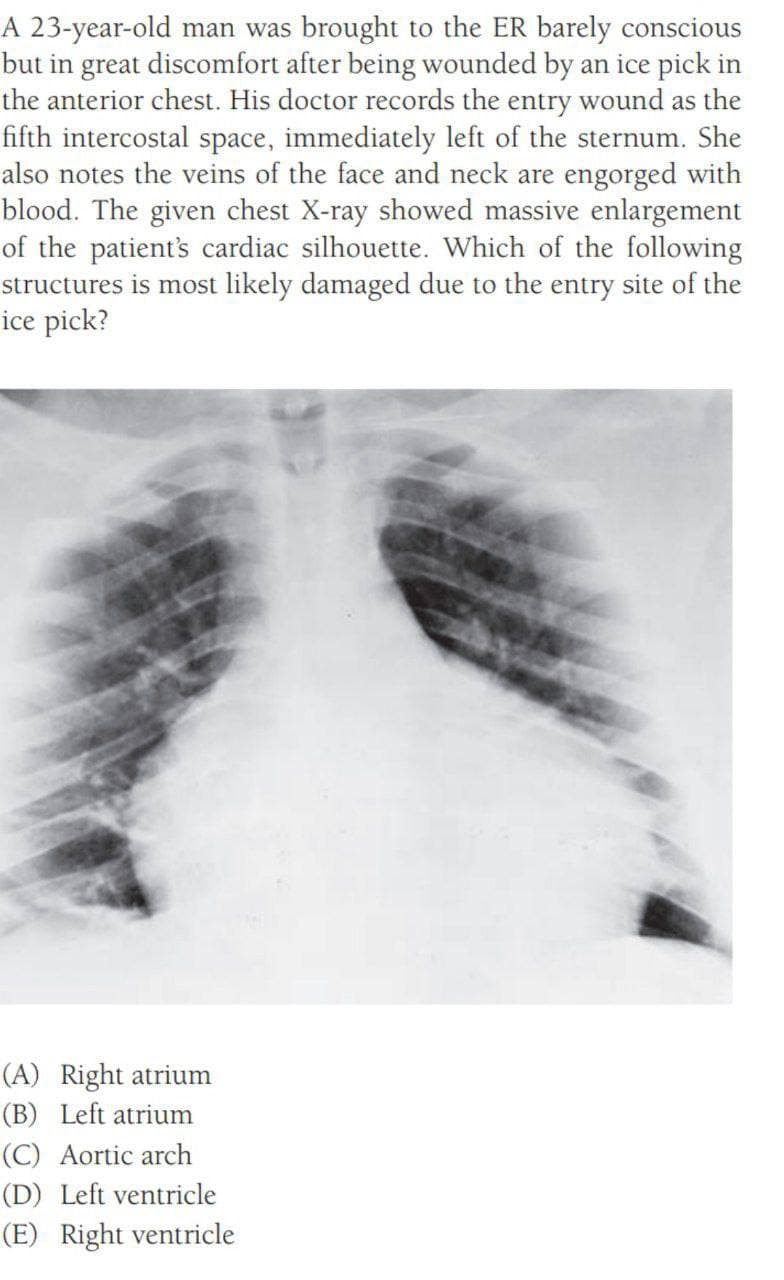 A 23-year-old man was brought to the ER barely conscious
but in great discomfort after being wounded by an ice pick in
the anterior chest. His doctor records the entry wound as the
fifth intercostal space, immediately left of the sternum. She
also notes the veins of the face and neck are engorged with
blood. The given chest X-ray showed massive enlargement
of the patient's cardiac silhouette. Which of the following
structures is most likely damaged due to the entry site of the
ice pick?
(A) Right atrium
(B) Left atrium
(C) Aortic arch
(D) Left ventricle
(E) Right ventricle
