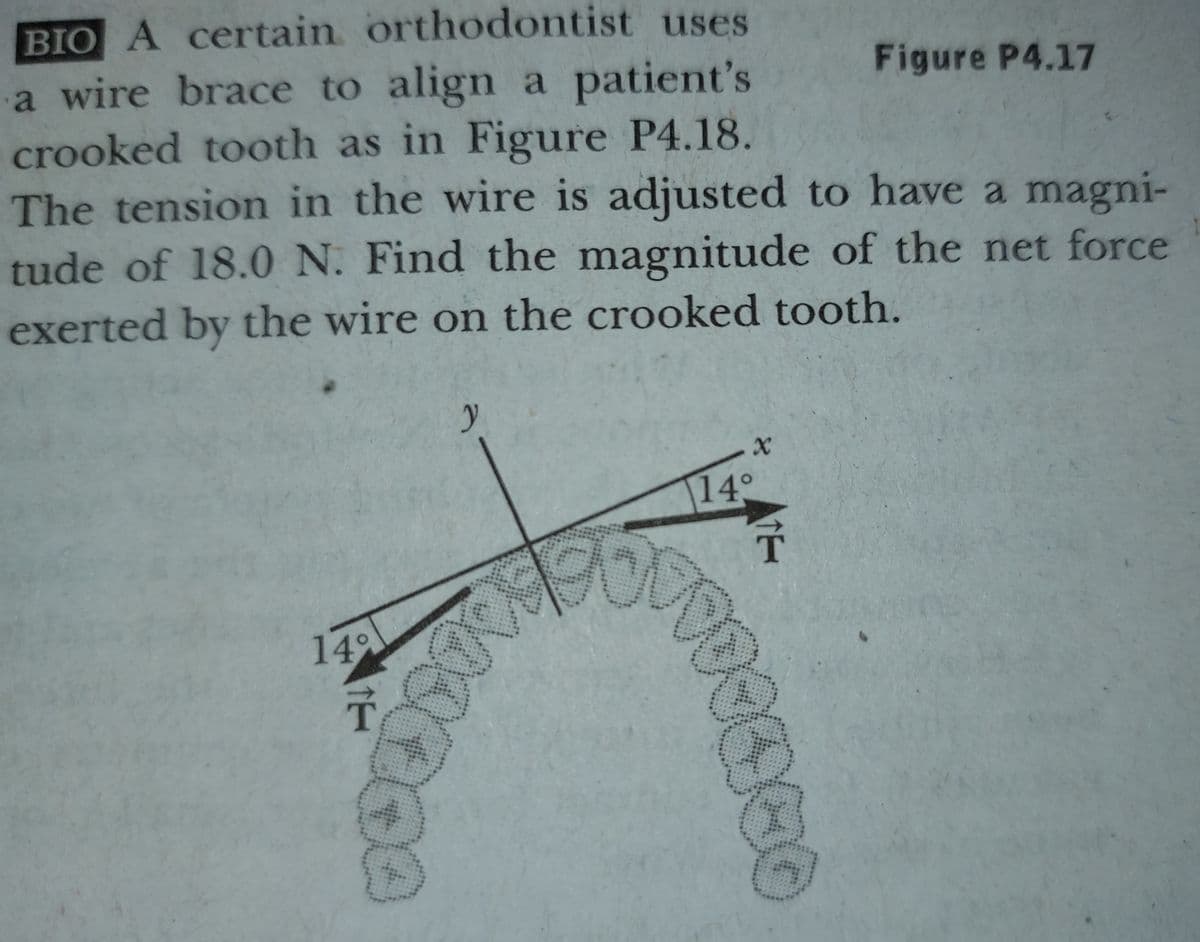 BIO A certain orthodontist uses
a wire brace to align a patient's
crooked tooth as in Figure P4.18.
The tension in the wire is adjusted to have a magni-
tude of 18.0 N. Find the magnitude of the net force
Figure P4.17
exerted by the wire on the crooked tooth.
149
14
T
