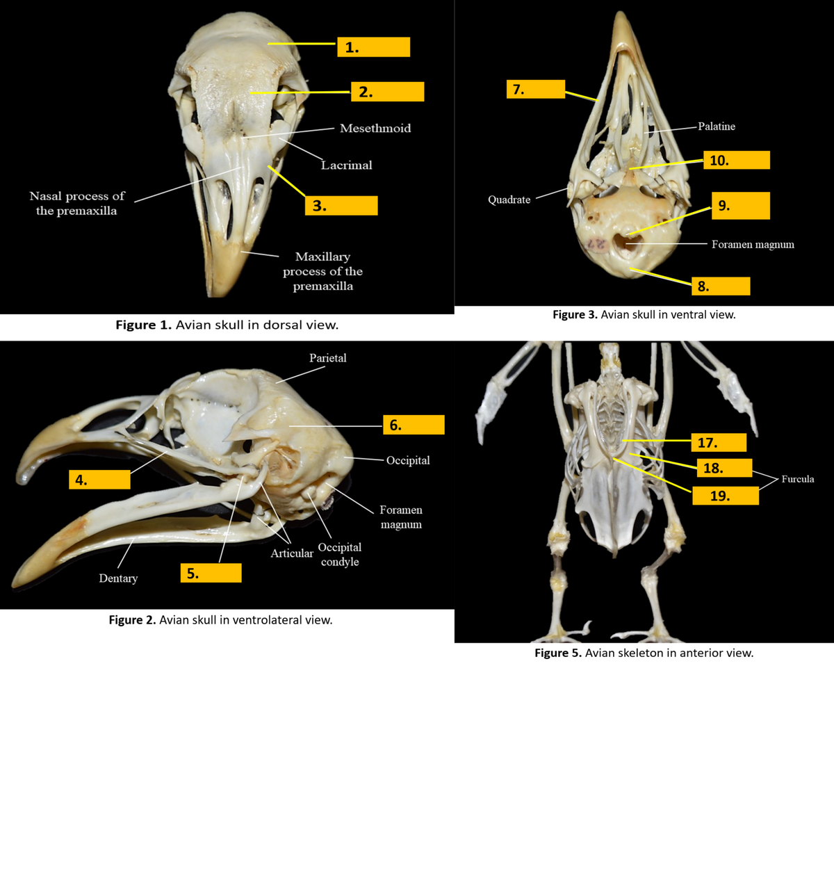 1.
2.
7.
Mesethmoid
-Palatine
Lacrimal
10.
Nasal process of
the premaxilla
3.
Quadrate
9.
Foramen magnum
Maxillary
process of the
premaxilla
8.
Figure 3. Avian skull in ventral view.
Figure 1. Avian skull in dorsal view.
Parietal
6.
17.
Оссірpital
18.
4.
Furcula
19.
Foramen
magnum
Articular Occipital
condyle
5.
Dentary
Figure 2. Avian skull in ventrolateral view.
Figure 5. Avian skeleton in anterior view.
