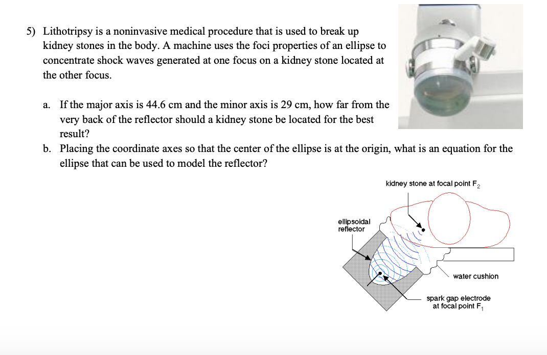 5) Lithotripsy is a noninvasive medical procedure that is used to break up
kidney stones in the body. A machine uses the foci properties of an ellipse to
concentrate shock waves generated at one focus on a kidney stone located at
the other focus.
а.
If the major axis is 44.6 cm and the minor axis is 29 cm, how far from the
very back of the reflector should a kidney stone be located for the best
result?
b. Placing the coordinate axes so that the center of the ellipse is at the origin, what is an equation for the
ellipse that can be used to model the reflector?
kidney stone at focal point F,
ellipsoidal
reflector
water cushion
spark gap electrode
at focal point F,
