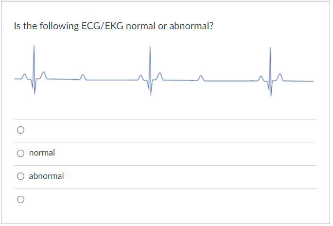 Is the following ECG/EKG normal or abnormal?
O normal
abnormal
