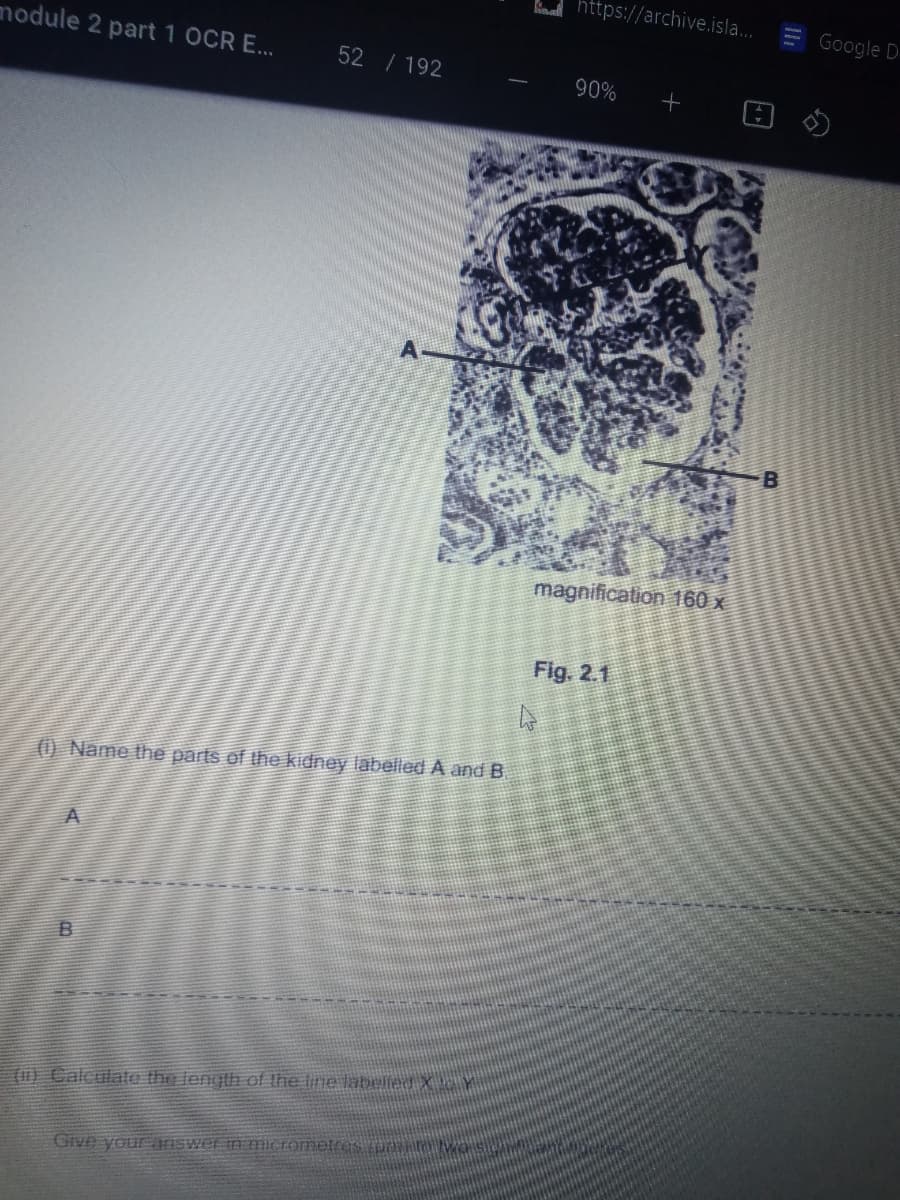 knad https://archive.isla...
E Google D
module 2 part 1 OCR E...
52 / 192
90%
magnification 160 x
Fig. 2.1
(1) Name the parts of the kidney labelled A and B.
A
(1) Calculato the length ef the line labelled X Y
Give your aISwer in mierometres os
