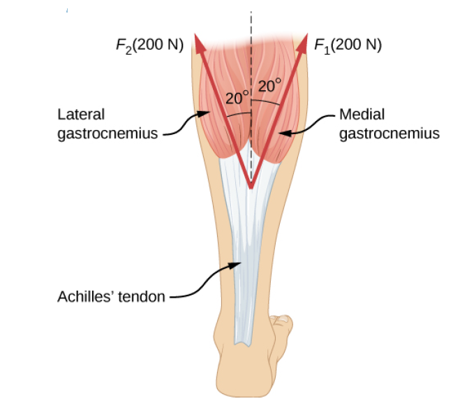 F2(200 N)
F;(200 N)
Lateral
20° 20°
Medial
gastrocnemius
gastrocnemius
Achilles' tendon
