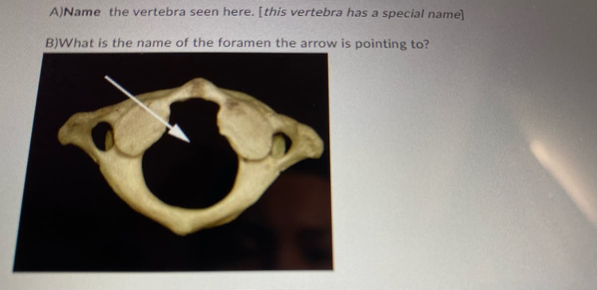 A)Name the vertebra seen here. [this vertebra has a special name]
B)What is the name of the foramen the arrow is pointing to?