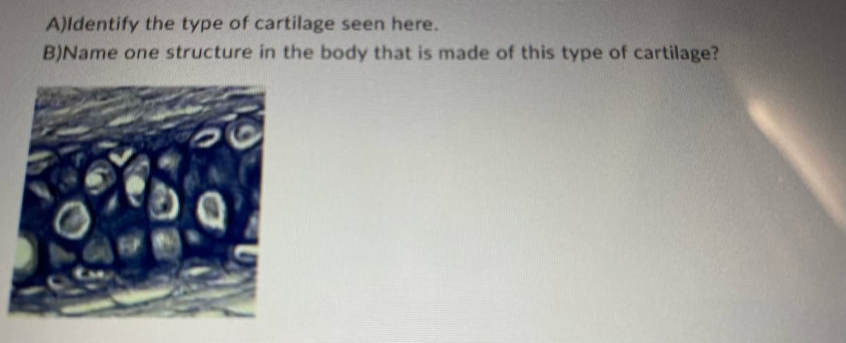 A)Identify the type of cartilage seen here.
B)Name one structure in the body that is made of this type of cartilage?