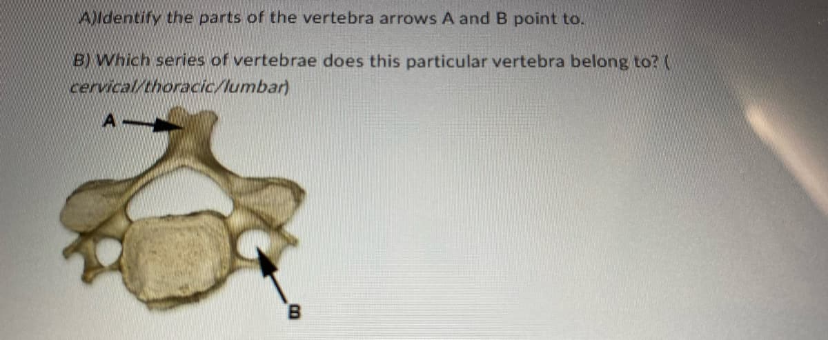 A)Identify the parts of the vertebra arrows A and B point to.
B) Which series of vertebrae does this particular vertebra belong to? (
cervical/thoracic/lumbar)
B