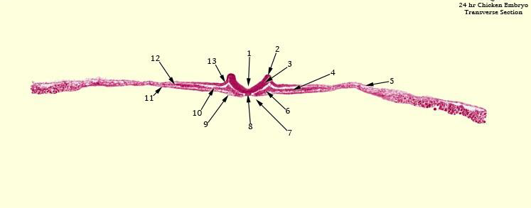 12
11
10
13
24 hr Chicken Embryo
Transverse Section