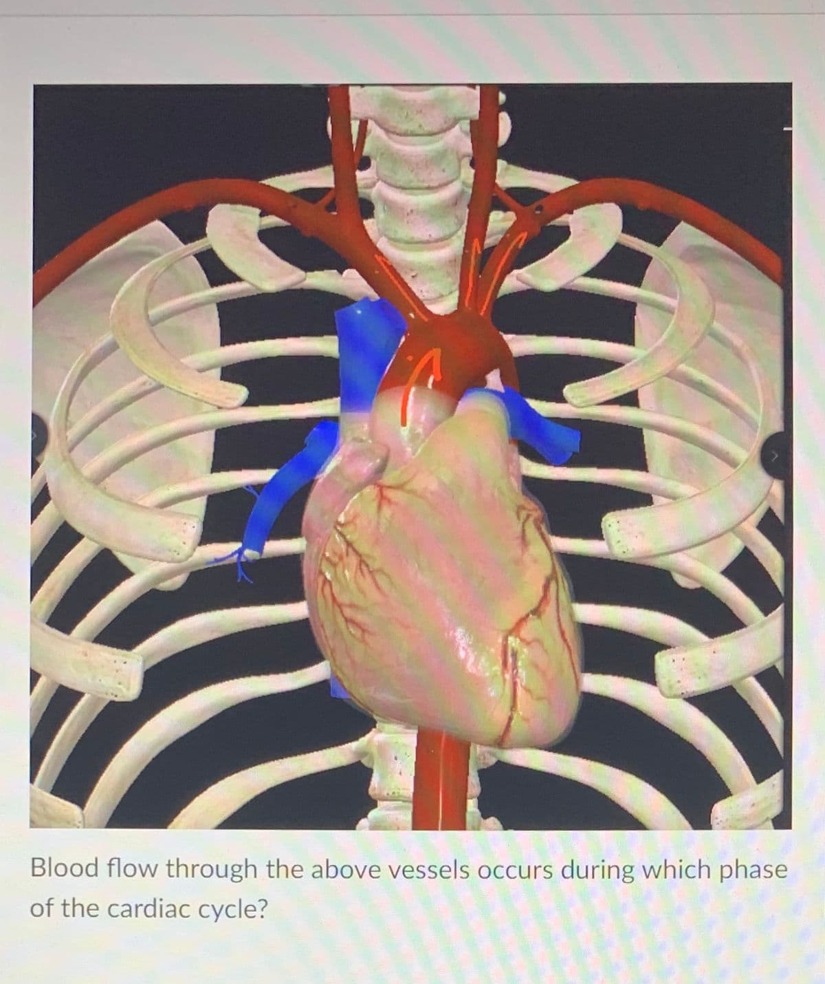 Blood flow through the above vessels occurs during which phase
of the cardiac cycle?

