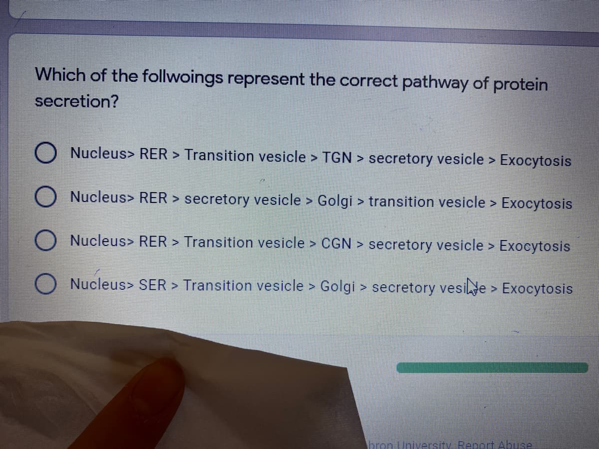 Which of the follwoings represent the correct pathway of protein
secretion?
O Nucleus> RER > Transition vesicle > TGN > secretory vesicle > Exocytosis
O Nucleus> RER > secretory vesicle > Golgi > transition vesicle > Exocytosis
O Nucleus> RER > Transition vesicle > CGN > secretory vesicle > Exocytosis
Nucleus> SER > Transition vesicle > Golgi > secretory vesilde > Exocytosis
Ibron University Peport Abuse!
