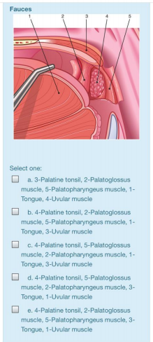 Fauces
Select one:
a. 3-Palatine tonsil, 2-Palatoglossus
muscle, 5-Palatopharyngeus muscle, 1-
Tongue, 4-Uvular muscle
b. 4-Palatine tonsil, 2-Palatoglossus
muscle, 5-Palatopharyngeus muscle, 1-
Tongue, 3-Uvular muscle
c. 4-Palatine tonsil, 5-Palatoglossus
muscle, 2-Palatopharyngeus muscle, 1-
Tongue, 3-Uvular muscle
d. 4-Palatine tonsil, 5-Palatoglossus
muscle, 2-Palatopharyngeus muscle, 3-
Tongue, 1-Uvular muscle
e. 4-Palatine tonsil, 2-Palatoglossus
muscle, 5-Palatopharyngeus muscle, 3-
Tongue, 1-Uvular muscle
