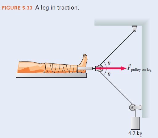 FIGURE 5.33 A leg in traction.
´pulley
leg
on
4.2 kg
