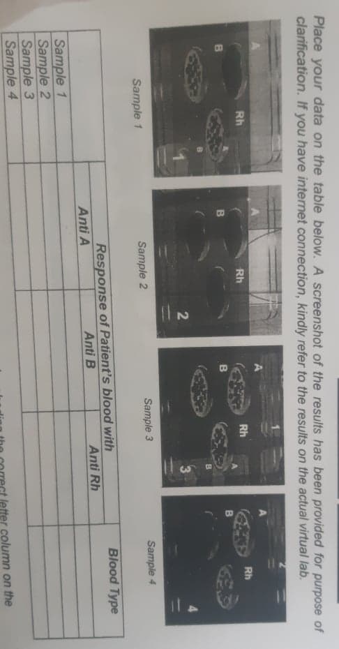 Place your data on the table below. A screenshot of the results has been provided for purpose of
clarification. If you have internet connection, kindly refer to the results on the actual virtual lab.
Rh
Rh
Rh
Rh
B\
B
Sample 1
Sample 2
Sample 3
Sample 4
Blood Type
Response of Patient's blood with
Anti B
Anti Rh
Anti A
Sample 1
Sample 2
Sample 3
Sample 4
letter column on the

