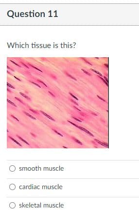 Question 11
Which tissue is this?
smooth muscle
cardiac muscle
O skeletal muscle
