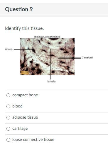 Question 9
Identify this tissue.
Histulagy Lab Part Slide 2
iacuna
Caraicul
lamela
compact bone
blood
adipose tissue
cartilage
loose connective tissue
