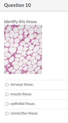 Question 10
Identify this tissue.
nervous tissue.
muscle tissue.
epithelial tissue.
connective tissue.
