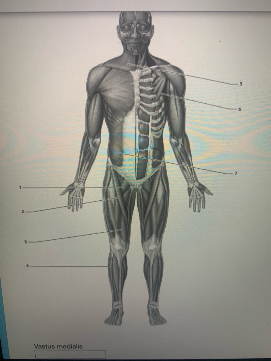 Vastus medialis
