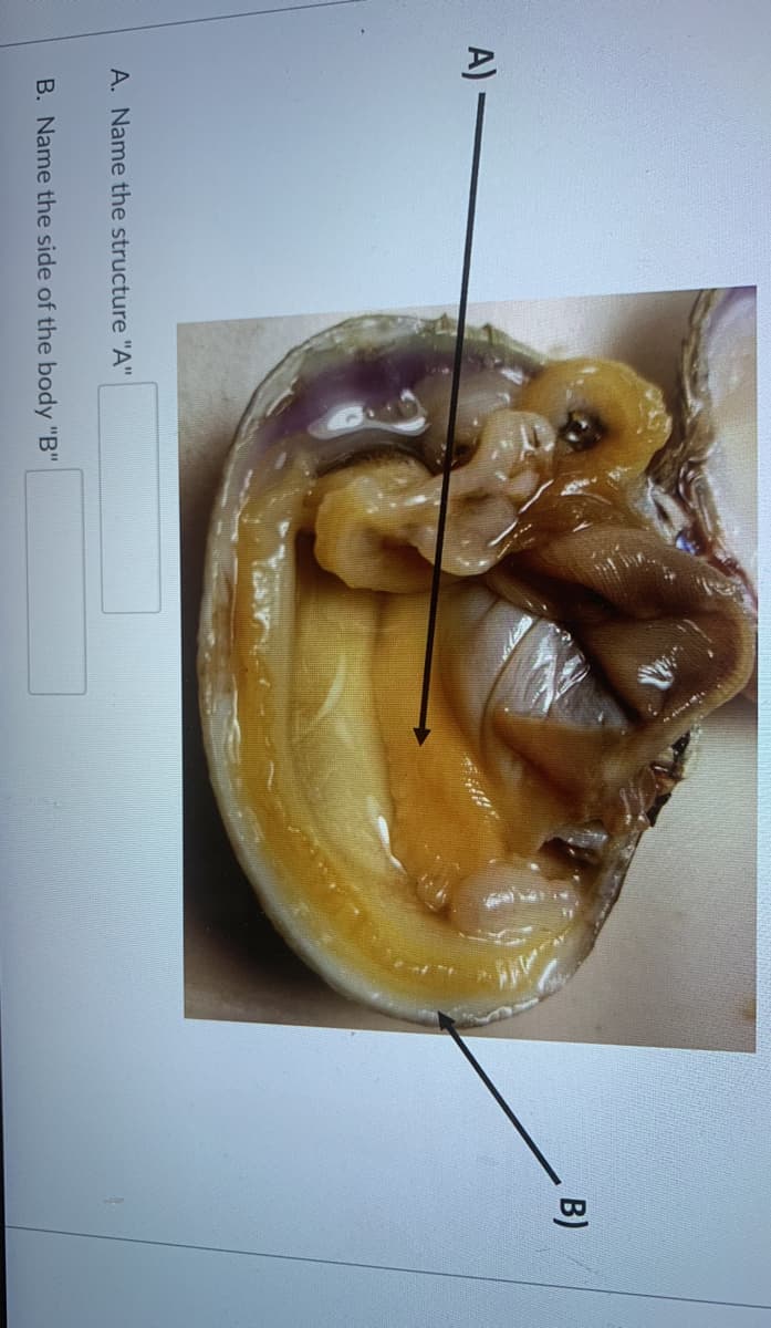 B)
A) -
A. Name the structure "A"
B. Name the side of the body "B"

