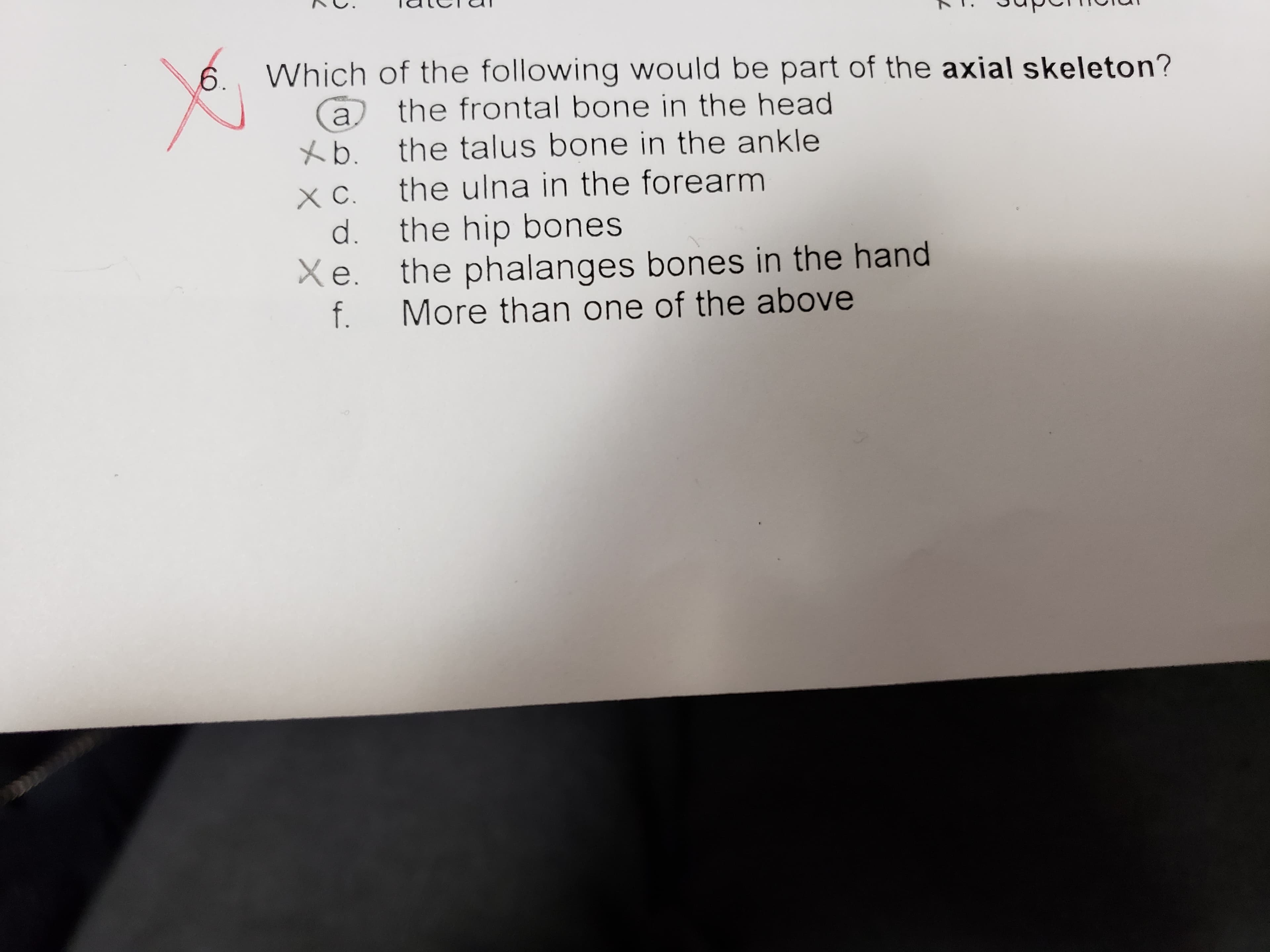 Which of the following would be part of the axial skeleton?
6.
the frontal bone in the head
a
the talus bone in the ankle
xb.
the ulna in the forearm
the hip bones
d.
Xe.
the phalanges bones in the hand
More than one of the above
f.
