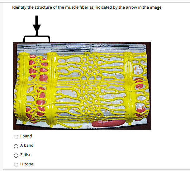Identify the structure of the muscle fiber as indicated by the arrow in the image.
pand
A band
Z disc
H zone
