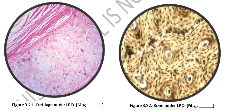 Figure 3.21. Cartilage under LPO. (Mag.
SI
Figure 3.22. Bone under LPO. (Mag.