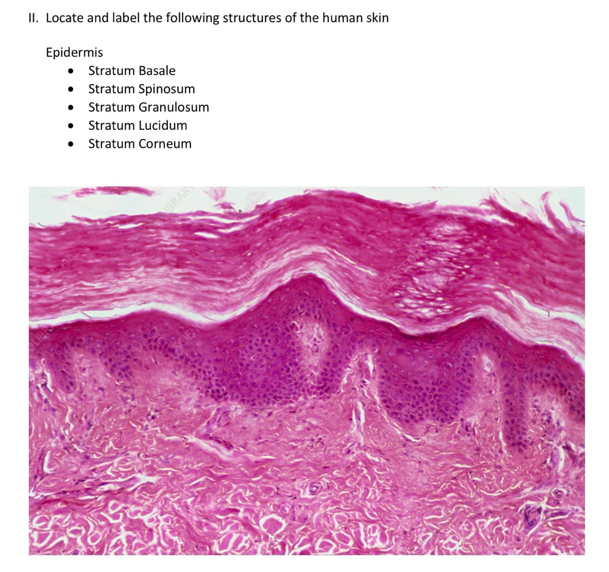 II. Locate and label the following structures of the human skin
Epidermis
Stratum Basale
Stratum Spinosum
Stratum Granulosum
Stratum Lucidum
Stratum Corneum
BRAR
