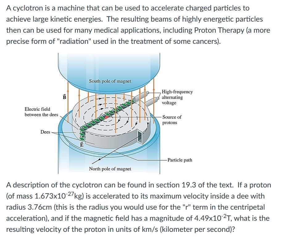 A cyclotron is a machine that can be used to accelerate charged particles to
achieve large kinetic energies. The resulting beams of highly energetic particles
then can be used for many medical applications, including Proton Therapy (a more
precise form of "radiation" used in the treatment of some cancers).
South pole of magnet
,High-frequency
alternating
voltage
Electric field
between the dees .
- Source of
protons
Dees
-Particle path
North pole of magnet
A description of the cyclotron can be found in section 19.3 of the text. If a proton
(of mass 1.673x10 27kg) is accelerated to its maximum velocity inside a dee with
radius 3.76cm (this is the radius you would use for the "r" term in the centripetal
acceleration), and if the magnetic field has a magnitude of 4.49x102T, what is the
resulting velocity of the proton in units of km/s (kilometer per second)?
