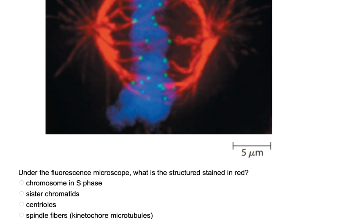 5 μm
Under the fluorescence microscope, what is the structured stained in red?
chromosome in S phase
O sister chromatids
O centrioles
Ospindle fibers (kinetochore microtubules)