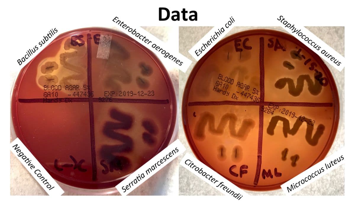 Data
Enterobacter aerogenes
Staphylococcus aureus
EC
SA
Escherichia coli
ELOOD AGAR S
GR10
Bacillus subtilis
-447436EXP:2019-18-82
Hardy Dx
BLOOD AGAR 5
EXP:2019-12-23
GA10
-447436
S284
おaNCS
Citrobacter freundii
CF
ML
Micrococcus luteus
Serratia marcescens
Negative Control
