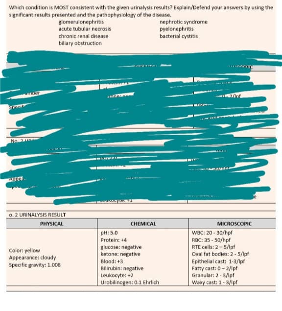 Which condition is MOST consistent with the given urinalysis results? Explain/Defend your answers by using the
significant results presented and the pathophysiology of the disease.
glomerulonephritis
acute tubular necrosis
nephrotic syndrome
pyelonephritis
bacterial cystitis
chronic renal disease
biliary obstruction
umber
No. 2U
Appe..
0. 2 URINALYSIS RESULT
PHYSICAL
CHEMICAL
MICROSCOPIC
WBC: 20 - 30/hpf
RBC: 35 - 50/hpf
RTE cells: 2-5/Ipf
Oval fat bodies: 2 -5/lpf
Epithelial cast: 1-3/lpf
Fatty cast: 0- 2/lpf
Granular: 2 - 3/lpf
Waxy cast: 1-3/lpf
pH: 5.0
Protein: +4
glucose: negative
ketone: negative
Blood: +3
Bilirubin: negative
Leukocyte: +2
Urobilinogen: 0.1 Ehrlich
Color: yellow
Appearance: cloudy
Specific gravity: 1.008
