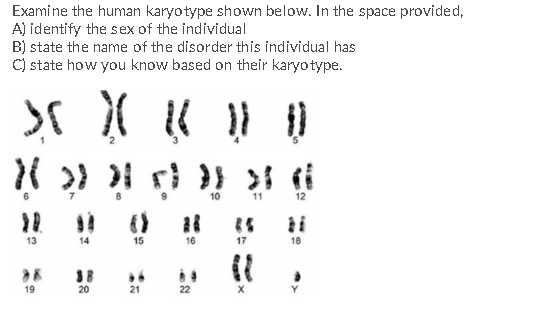 Examine the human karyotype shown below. In the space provided,
A) identify the sex of the individual
B) state the name of the disorder this individual has
C) state how you know based on their karyotype.
10
11
12
13
14
15
16
17
18
19
20
21
22
